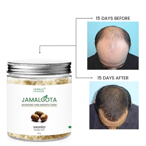 Jamalgota™ – 150ml Ayurvedic Powder for Hair Growth
